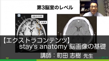 【エクストラコンテンツ】 stay's anatomy 脳画像の基礎