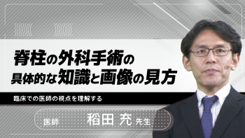 脊柱の外科手術の具体的な知識と画像の見方~臨床での医師の視点を理解する~