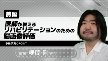 【前編】医師が教えるリハビリテーションのための脳画像評価~予後予測のPOINT~
