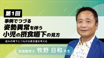 【第1回】事例でつづる姿勢異常を伴う小児の摂食嚥下の見方 ~成人の嚥下につながる食支援を考える~