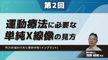 【第2回】運動療法に必要な単純X線像の見方　外力の加わり方と骨折の形（インプラント）