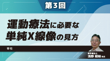 【第3回】運動療法に必要な単純X線像の見方　脊柱