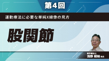 【第4回】運動療法に必要な単純X線像の見方　股関節