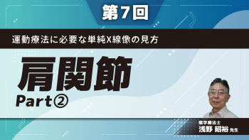 【第7回】運動療法に必要な単純X線像の見方 肩関節 Part②