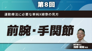 【第8回】運動療法に必要な単純X線像の見方 前腕・手関節