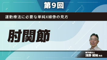 【第9回】運動療法に必要な単純X線像の見方 肘関節