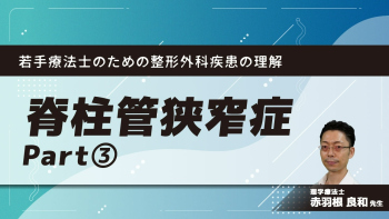 若手療法士のための整形外科疾患の理解~脊柱管狭窄症~ Part③