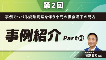 【第2回】事例でつづる姿勢異常を伴う小児の摂食嚥下の見方  ~事例紹介~ Part③事例-1