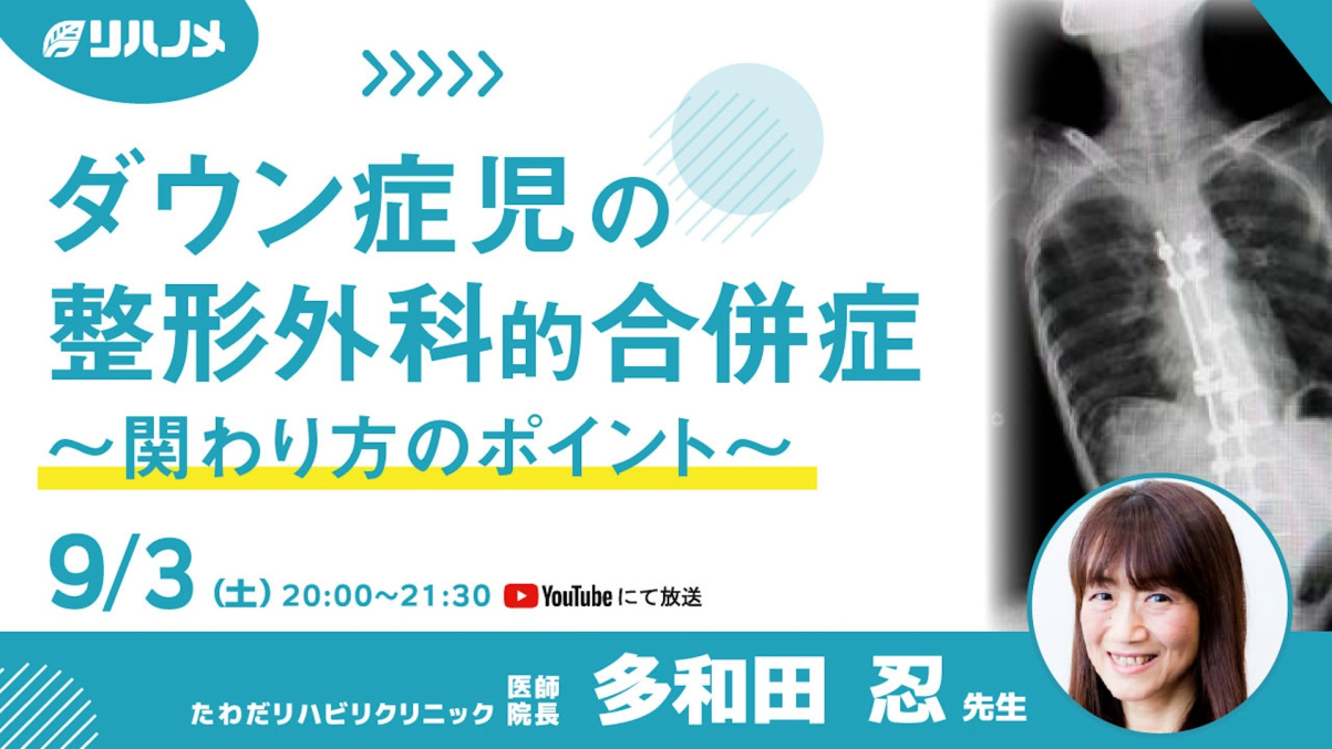 【2022/09/03配信】ダウン症児の整形外科的合併症～関わり方のポイント～