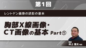 レントゲン画像の読影の基本 【第1回】胸部X線画像・CT画像の基本 Part①レントゲンの基本と解剖