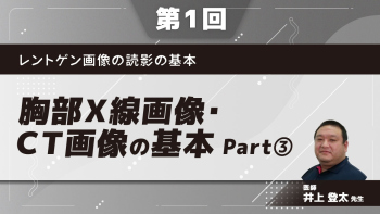レントゲン画像の読影の基本 【第1回】胸部X線画像・CT画像の基本 Part③病態ごとの特徴1