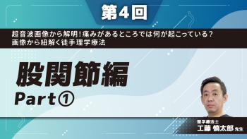 超音波画像から解明!痛みがあるところでは何が起こっている?画像から紐解く徒手理学療法 【第4回】股関節編 Part①股関節屈曲時痛の原因