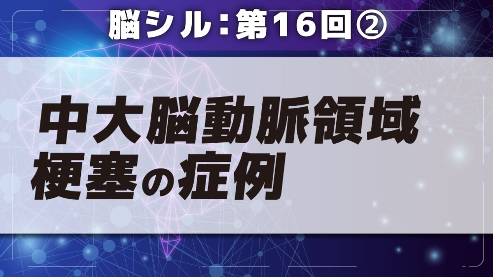 脳シル【第16回】中大脳動脈領域梗塞の脳画像読影 Part②中大脳動脈領域梗塞の症例