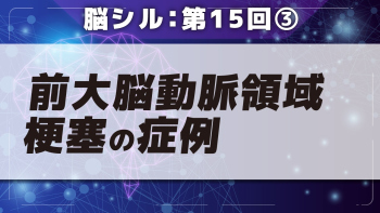 脳シル【第15回】前大脳動脈領域梗塞の脳画像読影 Part③前大脳動脈領域梗塞の症例