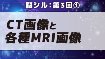 脳シル【第3回】脳画像の基礎 Part①CT画像と各種MRI画像
