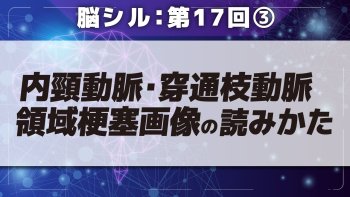 脳シル【第17回】後大脳動脈領域梗塞・内頸動脈領域梗塞・穿通枝動脈領域梗塞の脳画像読影 Part③内頸動脈・穿通枝動脈領域梗塞画像の読みかた