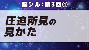 脳シル【第3回】脳画像の基礎 Part④圧迫所見の見かた