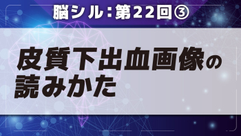 脳シル【第22回】その他の脳内出血の脳画像読影 Part③皮質下出血画像の読みかた