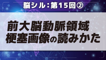 脳シル【第15回】前大脳動脈領域梗塞の脳画像読影 Part②前大脳動脈領域梗塞画像の読みかた