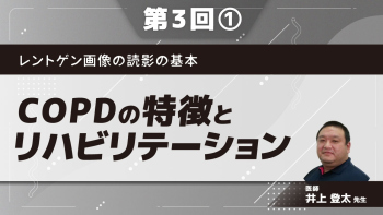 レントゲン画像の読影の基本 【第3回】COPDの特徴とリハビリテーション Part①COPDの疫学/病態1