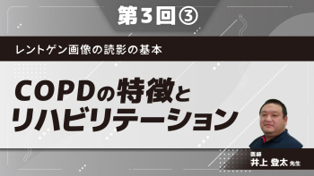 レントゲン画像の読影の基本 【第3回】COPDの特徴とリハビリテーション Part③COPDの治療1