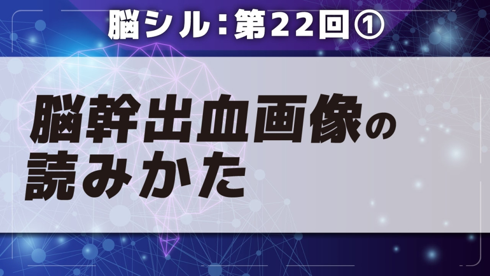 脳シル【第22回】その他の脳内出血の脳画像読影 Part①脳幹出血画像の読みかた