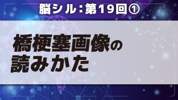 脳シル【第19回】橋梗塞・延髄梗塞の脳画像読影 Part①橋梗塞画像の読みかた