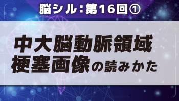 脳シル【第16回】中大脳動脈領域梗塞の脳画像読影 Part①中大脳動脈領域梗塞画像の読みかた