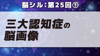 脳シル【第25回】認知症と脳萎縮の脳画像読影 Part①三大認知症の脳画像
