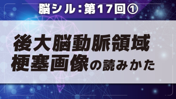 脳シル【第17回】後大脳動脈領域梗塞・内頸動脈領域梗塞・穿通枝動脈領域梗塞の脳画像読影 Part①後大脳動脈領域梗塞画像の読みかた