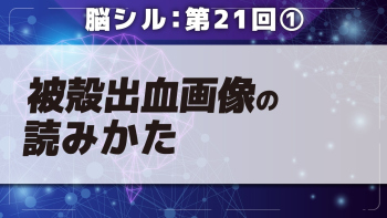 脳シル【第21回】被殻出血・視床出血の脳画像読影 Part①被殻出血画像の読みかた