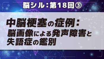 脳シル【第18回】小脳梗塞・中脳梗塞の脳画像読影 Part③中脳梗塞の症例:脳画像による発声障害と失語症の鑑別