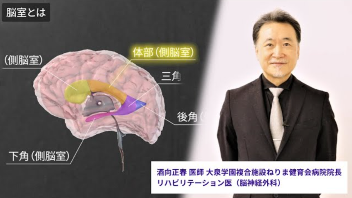 脳シル サービスイメージ動画