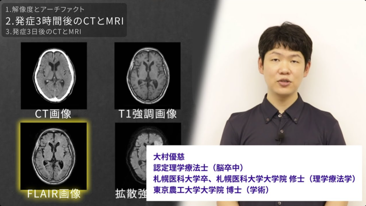 脳シル 講義イメージ動画