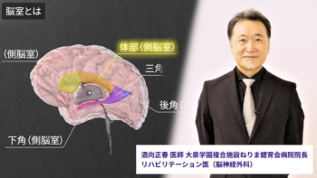 脳シル サービスイメージ動画