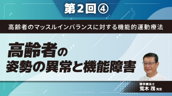 高齢者のマッスルインバランスに対する機能的運動療法【第2回】高齢者の姿勢の異常と機能障害 Part④骨盤後傾に対する理学療法1