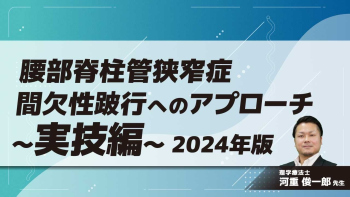 腰部脊柱管狭窄症 間欠性跛行へのアプローチ-2024年版- 実技編