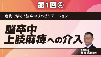 症例で学ぶ！脳卒中リハビリテーション 【第1回】脳卒中上肢麻痺への介入 Part④生活維持期の介入：症例3　