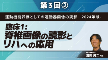 運動機能評価としての運動器画像の読影‐2024年版-【第3回】臨床1:脊椎画像の読影とリハへの応用 Part②