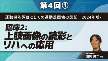 運動機能評価としての運動器画像の読影-2024年版- 【第4回】臨床2:上肢画像の読影とリハへの応用 Part①