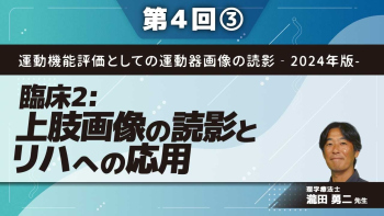 運動機能評価としての運動器画像の読影‐2024年版- 【第4回】臨床2:上肢画像の読影とリハへの応用 Part③