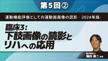 運動機能評価としての運動器画像の読影‐2024年版- 【第5回】臨床3:下肢画像の読影とリハへの応用 Part②